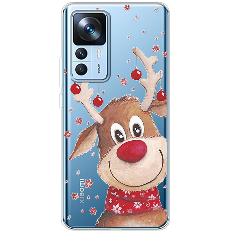 Прозрачный чехол BoxFace Xiaomi 12T / 12T Pro Winter Deer