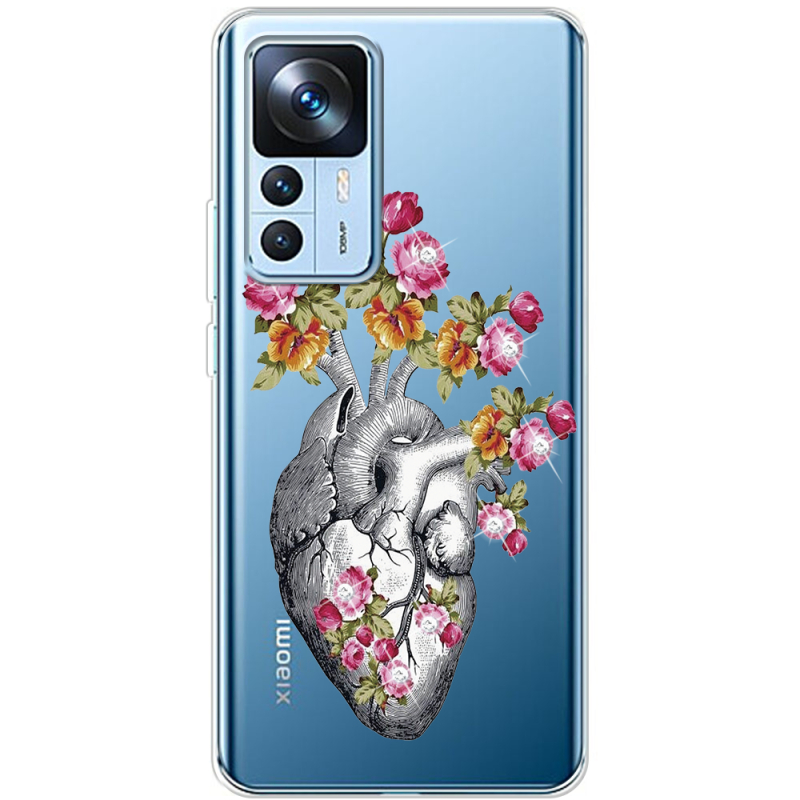 Чехол BoxFace со стразами Xiaomi 12T / 12T Pro Heart