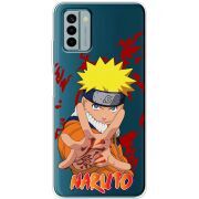 Прозрачный чехол BoxFace Nokia G22 Naruto