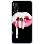 Чехол BoxFace Xiaomi Redmi Note 12 Pro 4G 