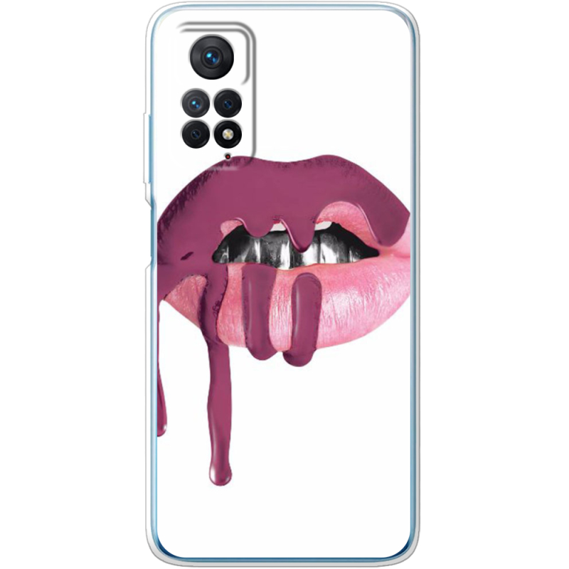 Чехол BoxFace Xiaomi Redmi Note 12 Pro 4G 