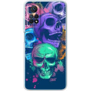Чехол BoxFace Xiaomi Redmi Note 12 Pro 4G 