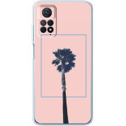 Чехол BoxFace Xiaomi Redmi Note 12 Pro 4G 