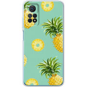 Чехол BoxFace Xiaomi Redmi Note 12 Pro 4G 