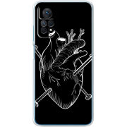 Чехол BoxFace Xiaomi Redmi Note 12 Pro 4G 