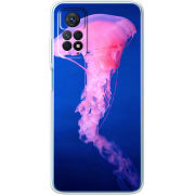 Чехол BoxFace Xiaomi Redmi Note 12 Pro 4G 
