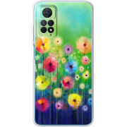 Чехол BoxFace Xiaomi Redmi Note 12 Pro 4G 