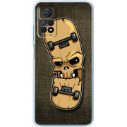 Чехол BoxFace Xiaomi Redmi Note 12 Pro 4G 