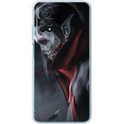 Чехол BoxFace Xiaomi Redmi Note 12 Pro 4G 