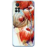Чехол BoxFace Xiaomi Redmi Note 12 Pro 4G 