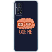 Чехол BoxFace Xiaomi Redmi Note 12 Pro 4G 