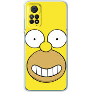 Чехол BoxFace Xiaomi Redmi Note 12 Pro 4G 