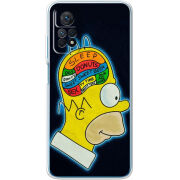 Чехол BoxFace Xiaomi Redmi Note 12 Pro 4G 