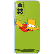 Чехол BoxFace Xiaomi Redmi Note 12 Pro 4G 