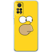 Чехол BoxFace Xiaomi Redmi Note 12 Pro 4G 
