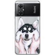 Прозрачный чехол BoxFace Xiaomi Redmi Note 11R Husky