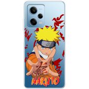 Прозрачный чехол BoxFace Xiaomi Redmi Note 12 Pro 5G Naruto