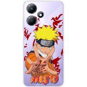 Прозрачный чехол BoxFace Infinix Hot 30 Play Naruto