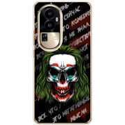 Чехол BoxFace OPPO Reno 10 Pro (China) 