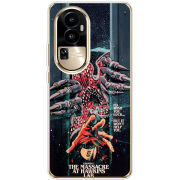 Чехол BoxFace OPPO Reno 10 Pro (China) 