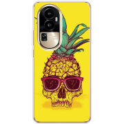 Чехол BoxFace OPPO Reno 10 Pro (China) Pineapple Skull