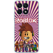 Чехол BoxFace Honor X8a Follow Me to Roblox