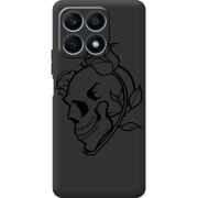 Черный чехол BoxFace Honor X8a Skull and Roses