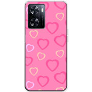 Чехол BoxFace OnePlus Nord N20 SE Sugar Hearts