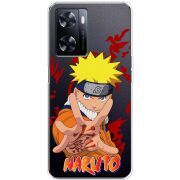 Прозрачный чехол BoxFace OnePlus Nord N20 SE Naruto