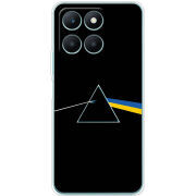 Чехол BoxFace Honor X6a Pink Floyd Україна