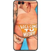 Чехол Uprint Xiaomi Mi6 