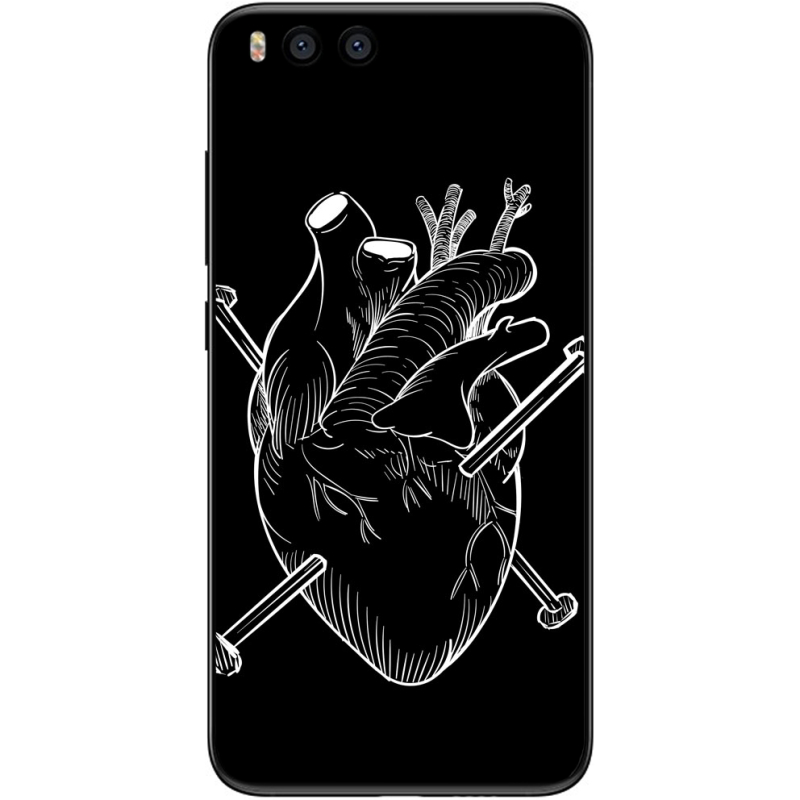 Чехол Uprint Xiaomi Mi6 