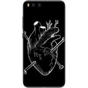 Чехол Uprint Xiaomi Mi6 