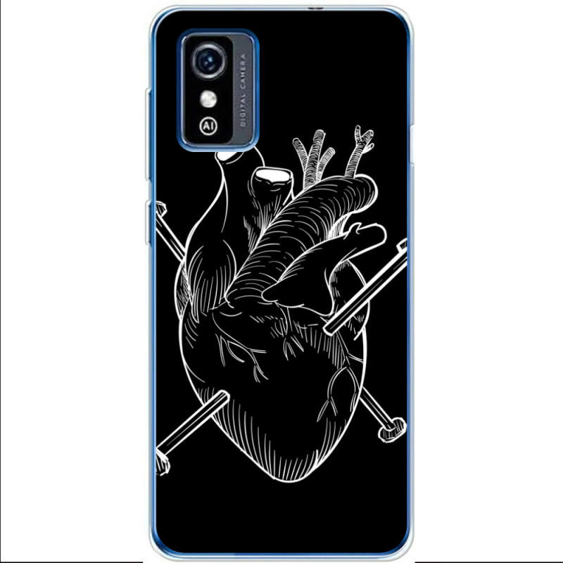 Чехол BoxFace ZTE Blade L9 