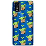 Прозрачный чехол BoxFace ZTE Blade L9 Pattern Baby Yoda