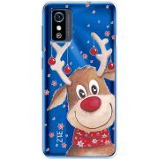 Прозрачный чехол BoxFace ZTE Blade L9 Winter Deer