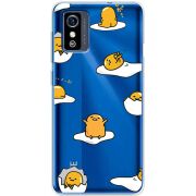 Прозрачный чехол BoxFace ZTE Blade L9 Gudetama