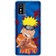 Прозрачный чехол BoxFace ZTE Blade L9 Naruto