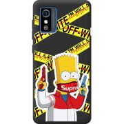 Черный чехол BoxFace ZTE Blade L9 White Bart