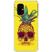 Чехол BoxFace Xiaomi Poco M4 5G Pineapple Skull