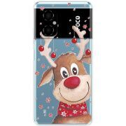 Прозрачный чехол BoxFace Xiaomi Poco M4 5G Winter Deer