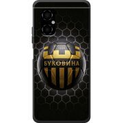 Черный чехол BoxFace Poco M4 5G 