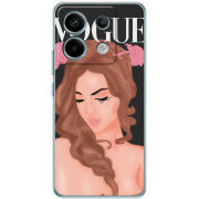 Чехол BoxFace Xiaomi Redmi Note 13 Pro 5G Fashion Girl