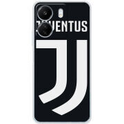 Чехол BoxFace Xiaomi Redmi 13C FC J