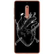 Чехол Uprint Nokia 5 