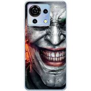 Чехол BoxFace ZTE Blade V50 Vita Prankster