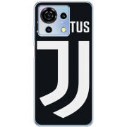 Чехол BoxFace ZTE Blade V50 Vita FC J