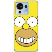 Чехол BoxFace ZTE Blade V50 Vita 