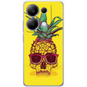 Чехол BoxFace Xiaomi Redmi Note 13 Pro 4G Pineapple Skull