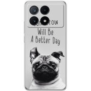 Чехол BoxFace Xiaomi Poco X6 Pro 5G 